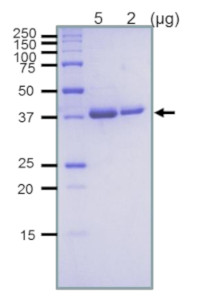 RuvB (protein, positive control) in the group Antibodies Other Species / Bacteria at Agrisera AB (Antibodies for research) (AS21 4544P)